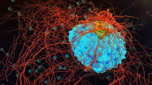 T-Cell Lymphoma