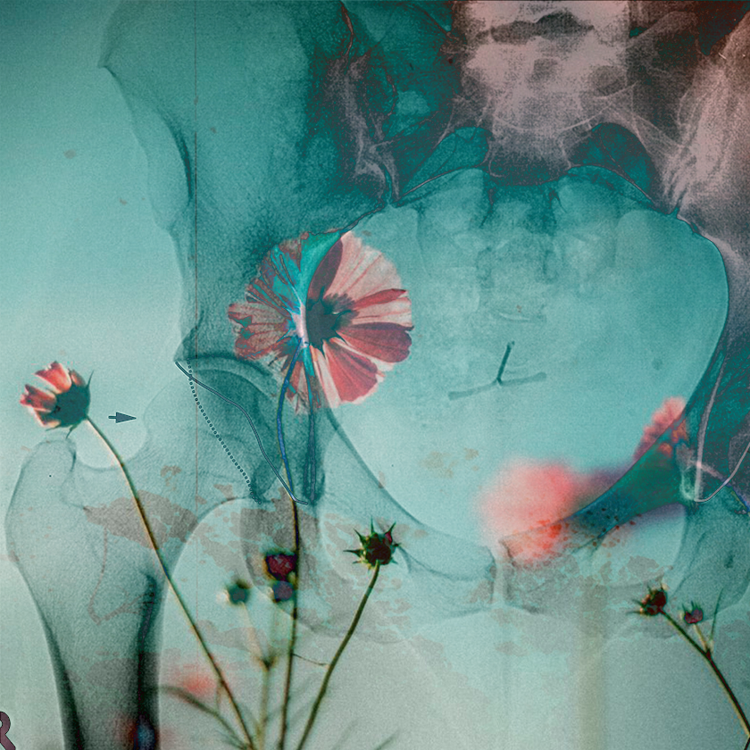 flowers and death #9 static token preview